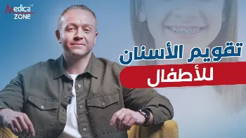ما السن المناسب لعمل تقويم الاسنان للاطفال؟